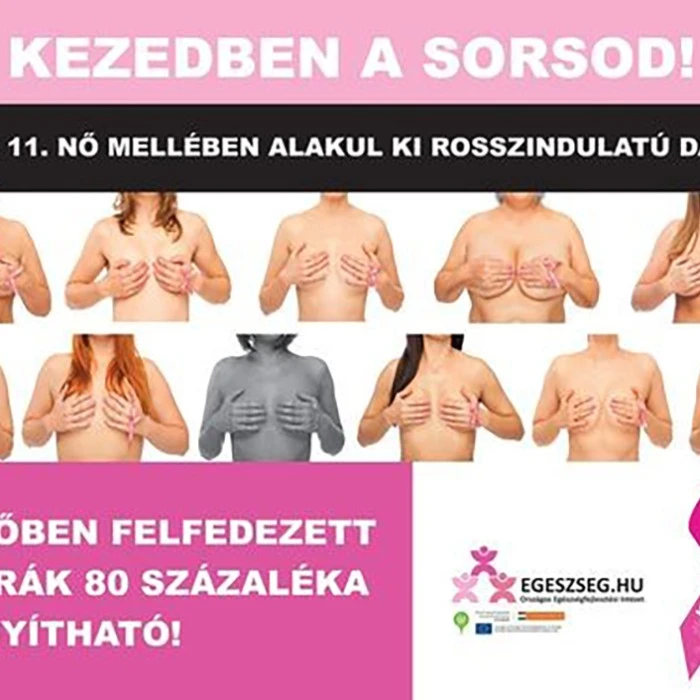 felhívás emlőszűrésre! képe