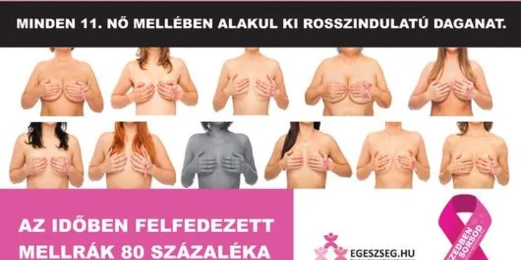 felhívás emlőszűrésre! képe